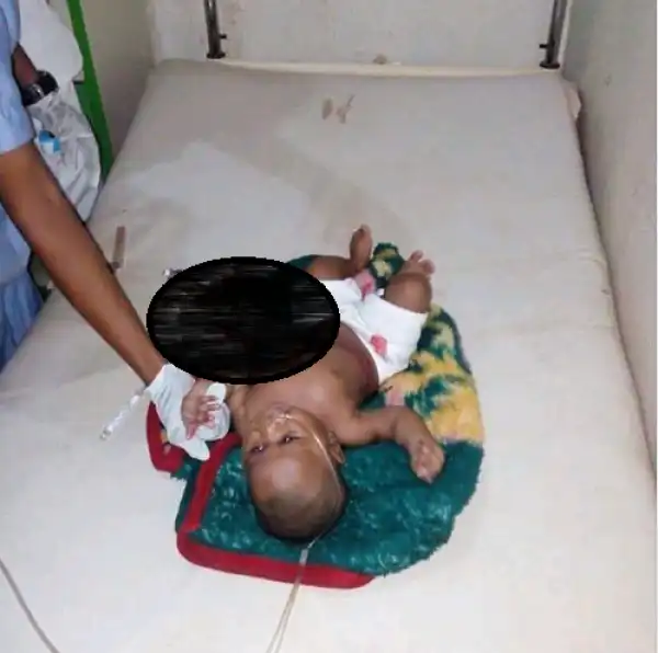 Woman Stabs Her 8-Month-Old Baby In His Stomach In Ebonyi (Graphic Photo)